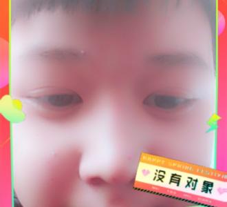 【拍拍拍】视频直播-YY