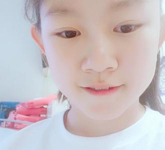 医生我要做翻领改圆领手术,你们知道做什么.