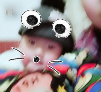 医生我要做翻领改圆领手术,你们知道做什么.