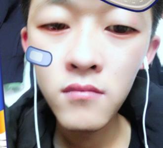 【求关注】视频直播-YY