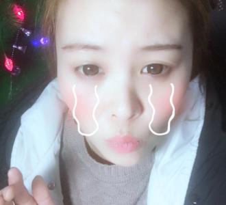 #一起涨知识#蛋清香蕉皮,眼袋的天敌