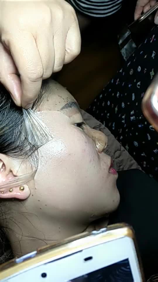 中药皮膜祛斑,根除雀斑,招加盟商视频直播全集